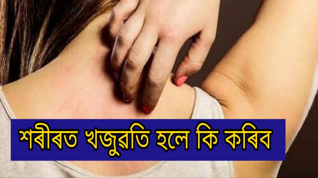 "Skin itching problem on body"